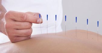 Akupunktur är en vetenskapligt beprövad metod för att lindra smärta inom en mängd olika tillstånd.